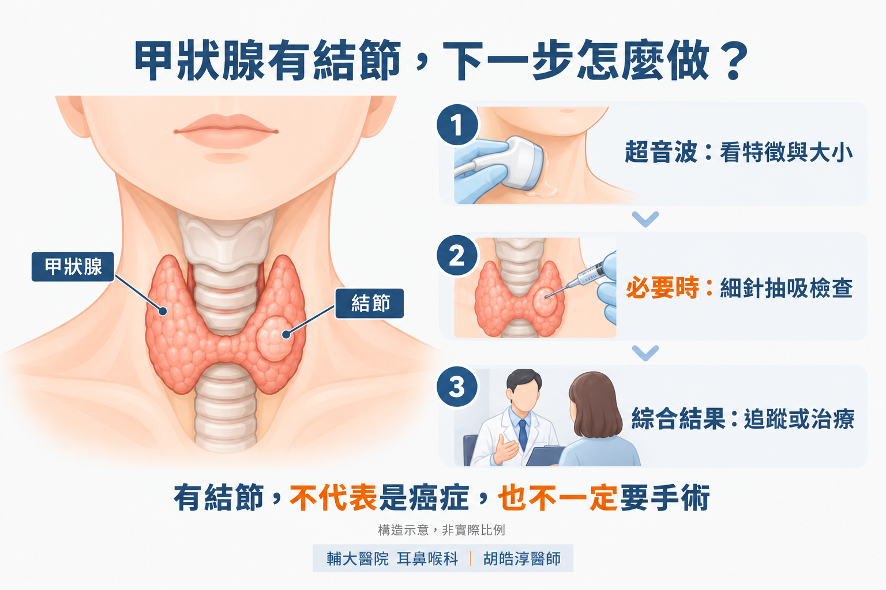 甲狀腺結節評估示意:先看超音波特徵與大小,再判斷是否需要細針抽吸