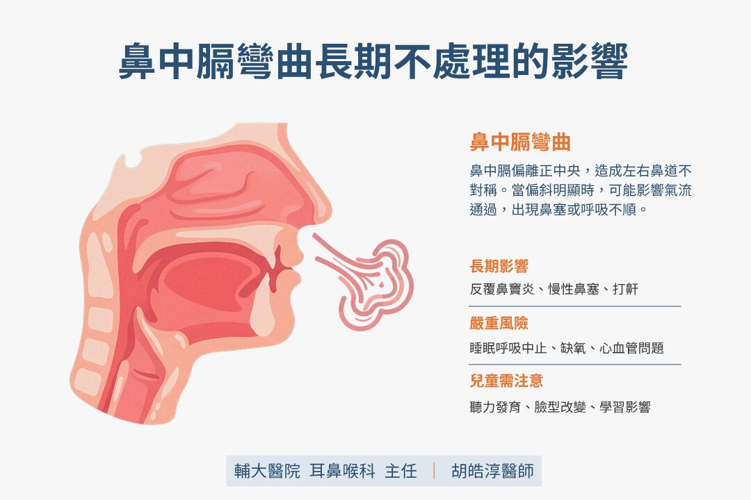 鼻中 隔 彎曲是什麼?症狀、原因與就醫時機