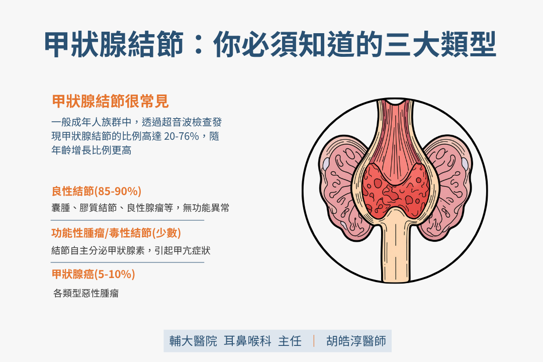 甲狀腺腫瘤是什麼?良性結節、惡性腫瘤與功能性腫瘤辨別