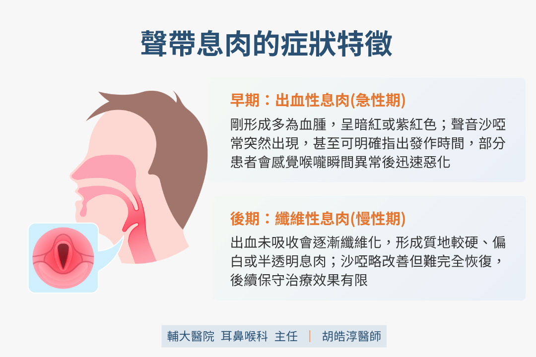 聲帶息肉的症狀特徵