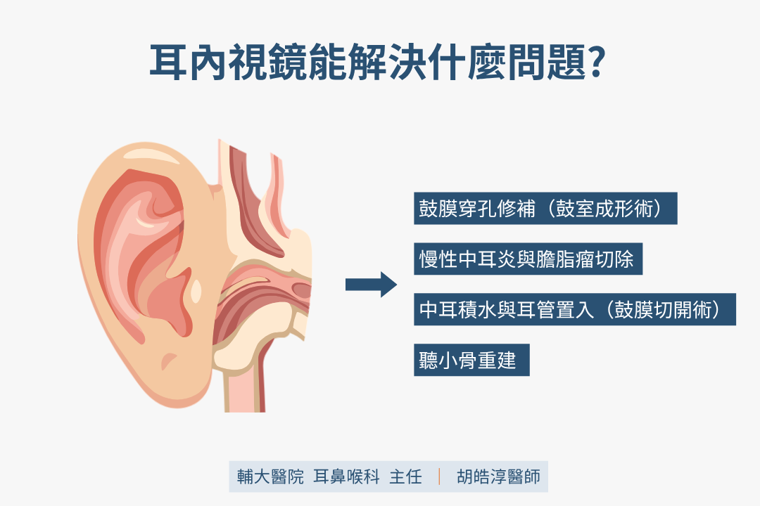 耳內視鏡能解決什麼問題?