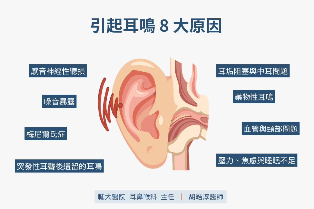引起耳鳴的 8 大原因